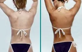 Olive before-and-after 01